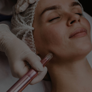 Micro Needling